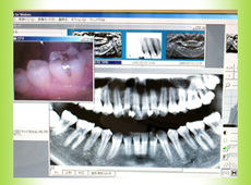 �R���s���[�^�[�ɂ��摜�f�f